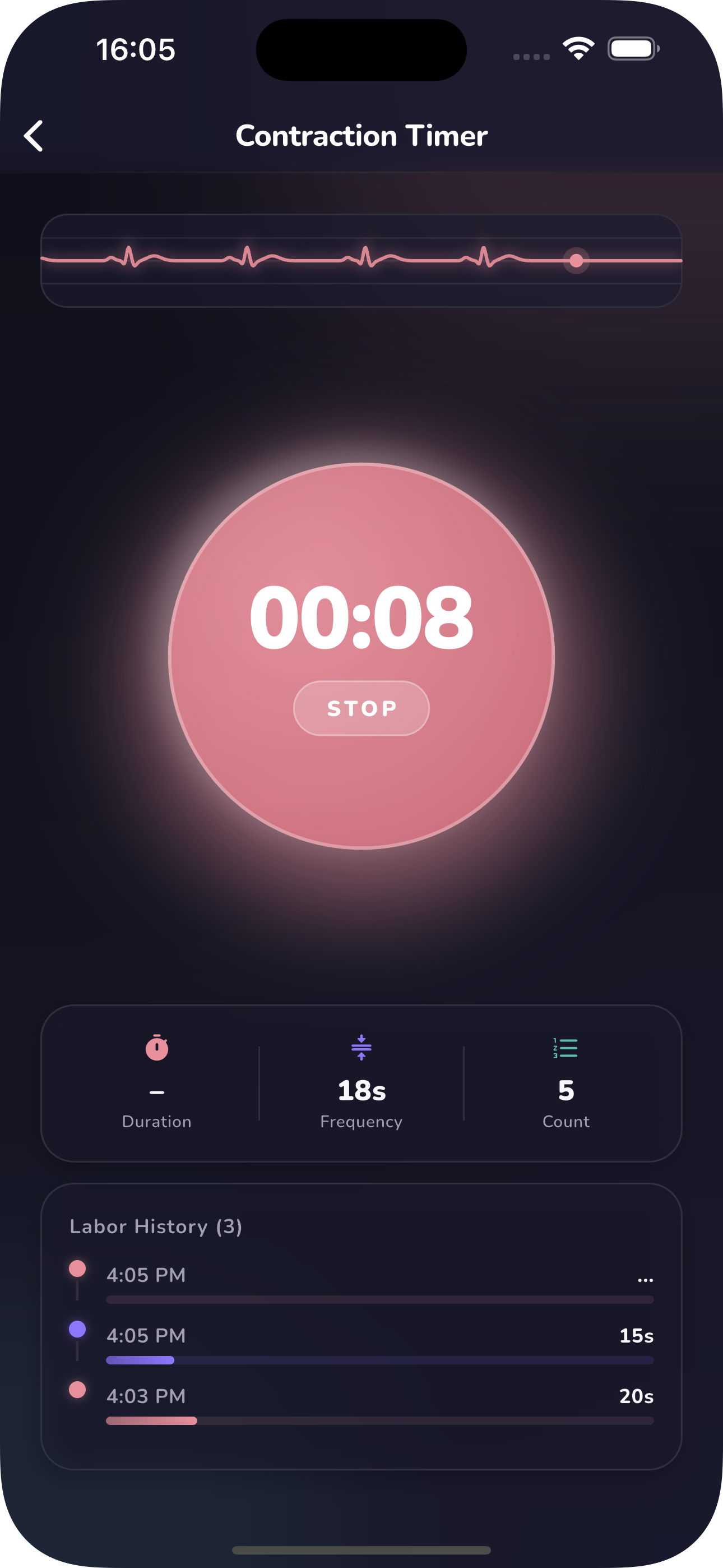 Contraction Timer